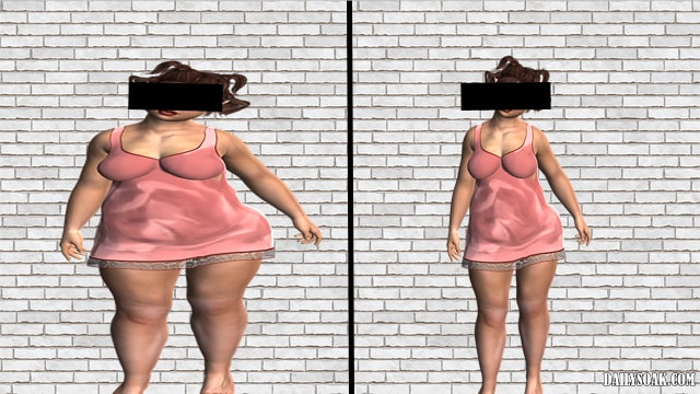 Before and after weight loss of a woman.