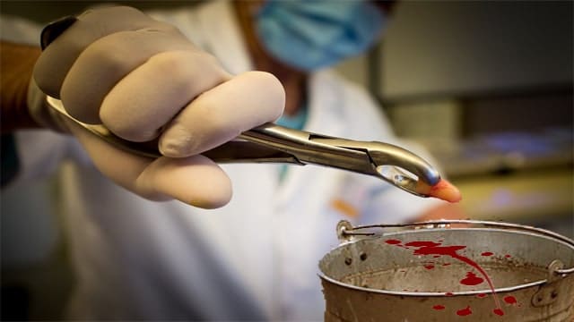 Male dentist in white coat extracting tooth.