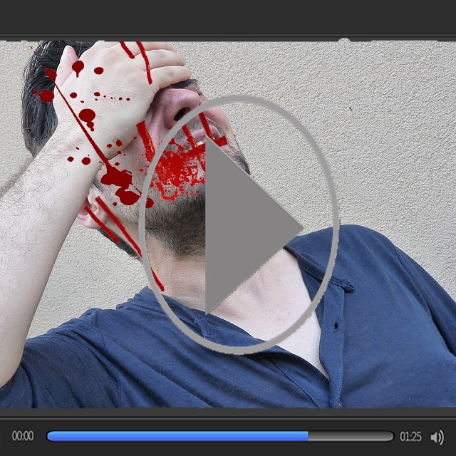 White man holding forehead in pain with blood running down his face.