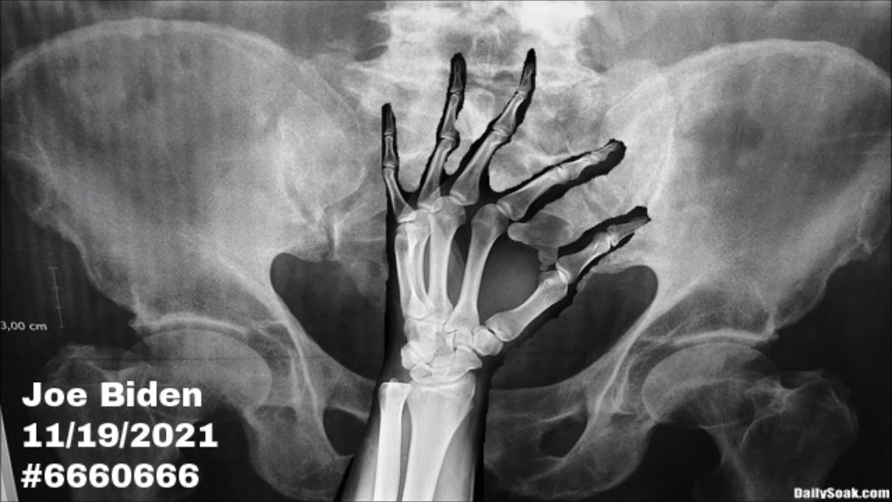 A parody x-ray of Joe Biden's lower abdomen.