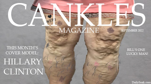 Hillary Clinton's showing her cankles on cover of parody magazine.